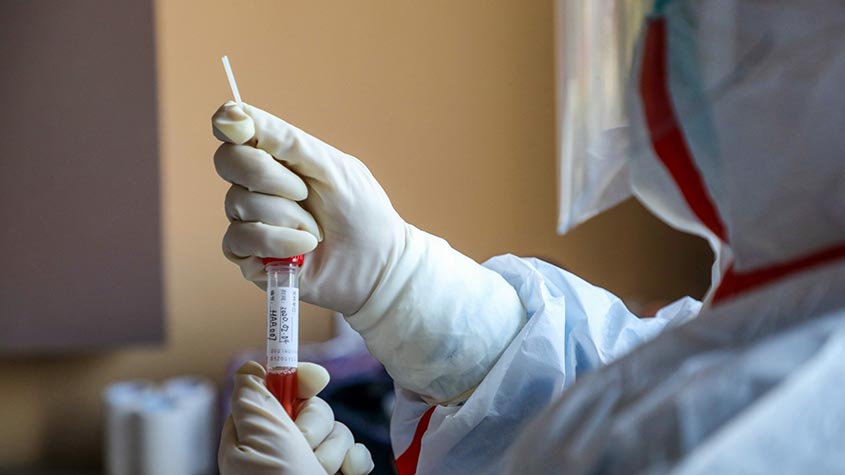 Через новий штам коронавірусу в Україні змінять ПЛР-тести